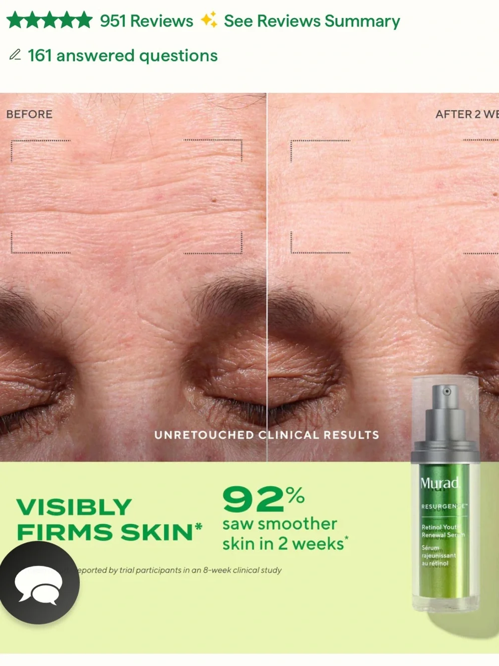 Murad Resurgence Retinol Youth Renewal Serum — Green and Silver Pump